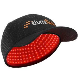 illumiflow 302 Flex