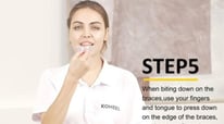 All You Need to Know About KOHEEL MGM Orthodontics