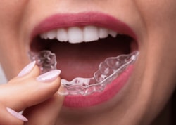SmilePath