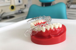 Straight My Teeth