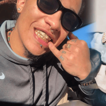 Custom Gold Grillz
