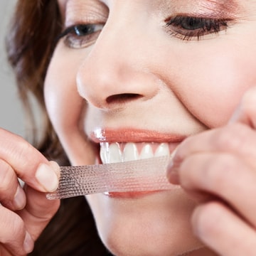 Direct Teeth Whitening