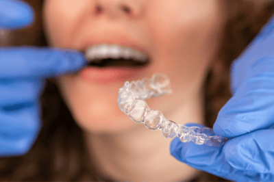 These 8 Aligner32 Promotions Are Worth Reviewing Before Starting Clear Aligner Treatment This July 2026