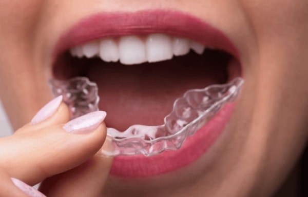 SmilePath Banner
