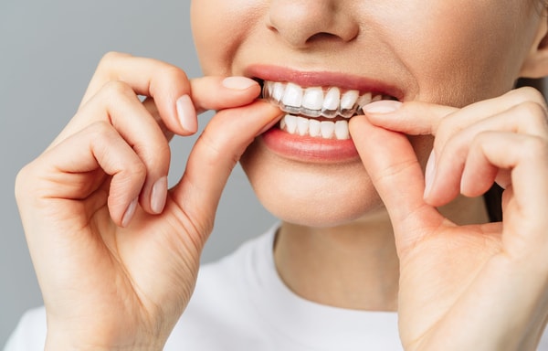 SmileSet Banner