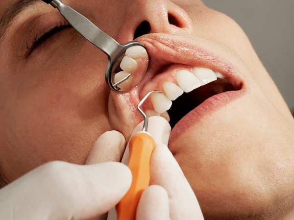 About 1Dental