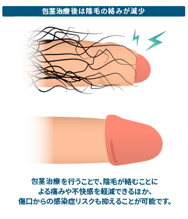 ABC Clinic ABC式Sカット レビュー