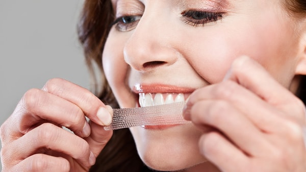 Overview of Direct Teeth Whitening