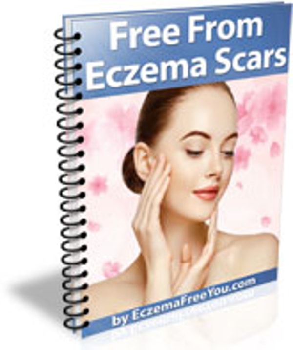 About Eczema Free You