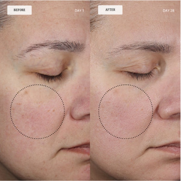 About EXOCEUTICALS 