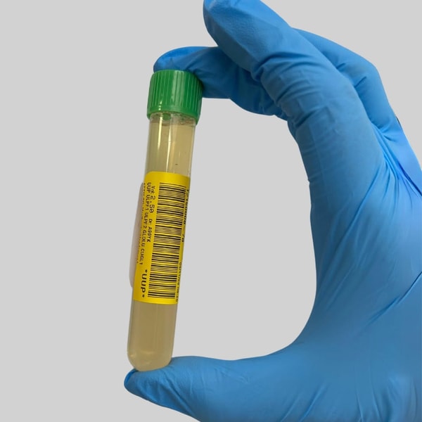 Genova Connect Metabolomix+ Nutritional Test Review