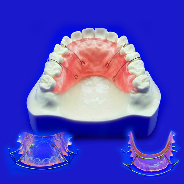 iHome Dental Hawley Retainer Review