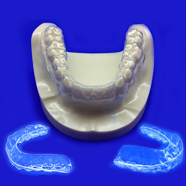 iHome Dental Invisible Retainers Review