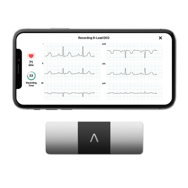 Kardia Mobile 6L Reviews