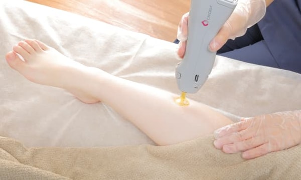 Lucia Clinic 全身脱毛 レビュー