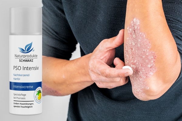 &Uuml;berblick &uuml;ber Naturprodukte Schwarz