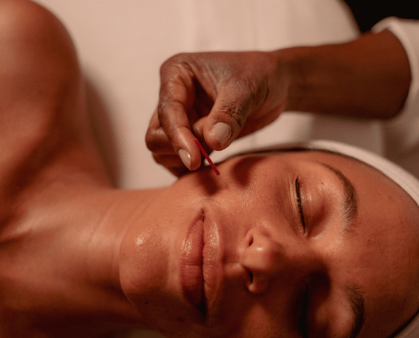 ORA Method Acupuncture Facial Review