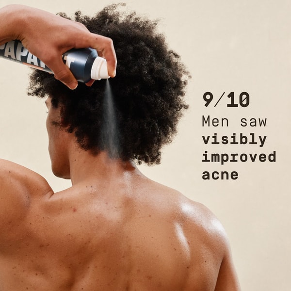 PAPATUI Acne Fighting Body Spray Review