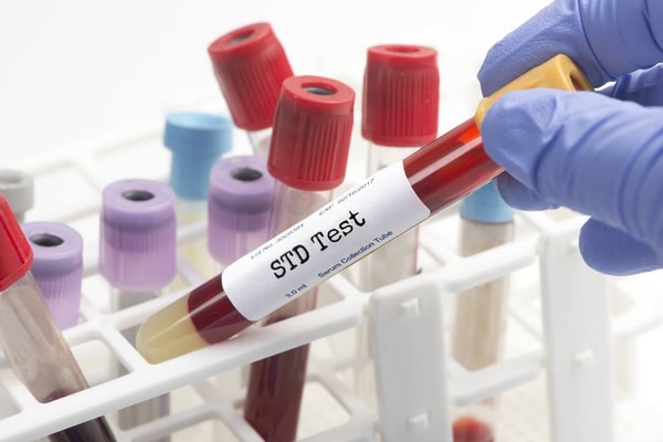 What to Expect from Priority STD Testing