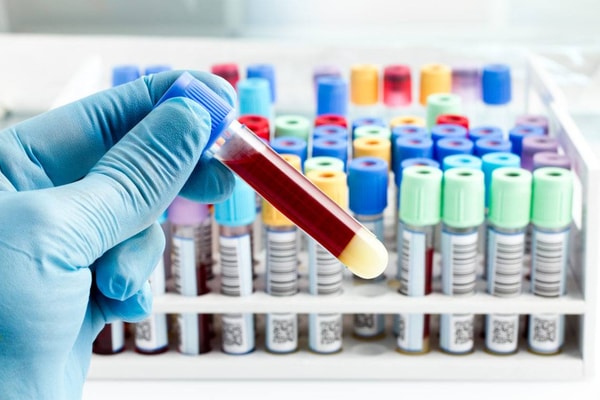 Priority STD Testing Twin STD Panel Reviews