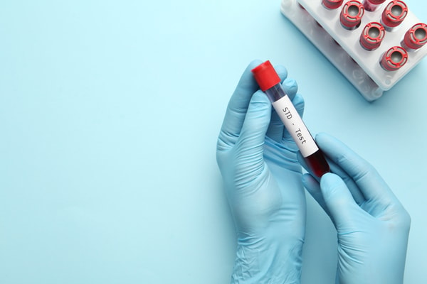 Priority STD Testing 10 Panel STD Test Reviews