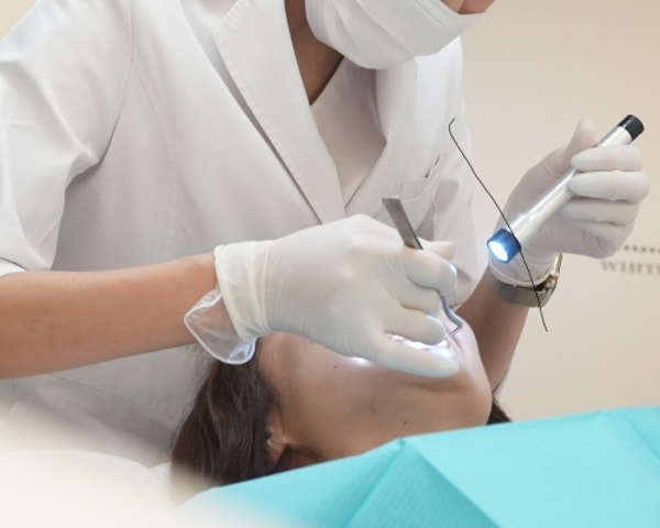 Star Whitening スタンダードホワイトニング レビュー