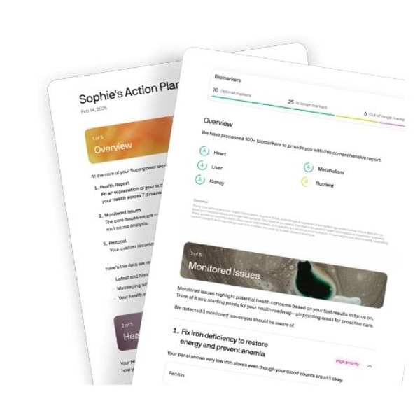 Superpower Service Review
