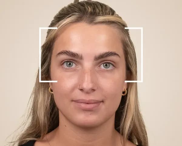 Th&eacute;rapie Clinic Cosmetic Injections Review
