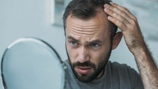 The Care Pharmacy Hair Loss Reviews