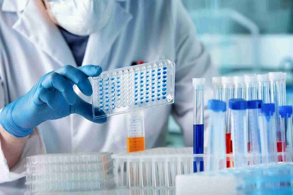 Vitall Check Complete Health & Performance Blood Test Reviews