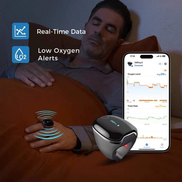Wellue O2Ring Review