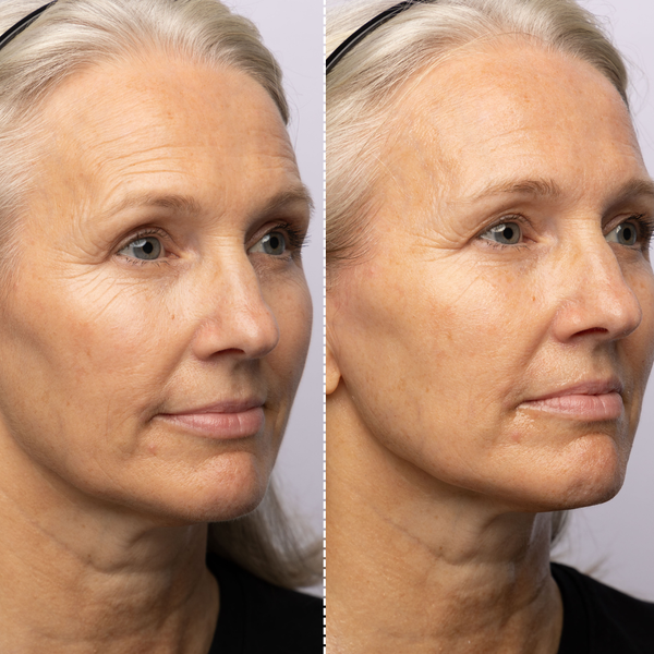 ZIIP Beauty Recensione