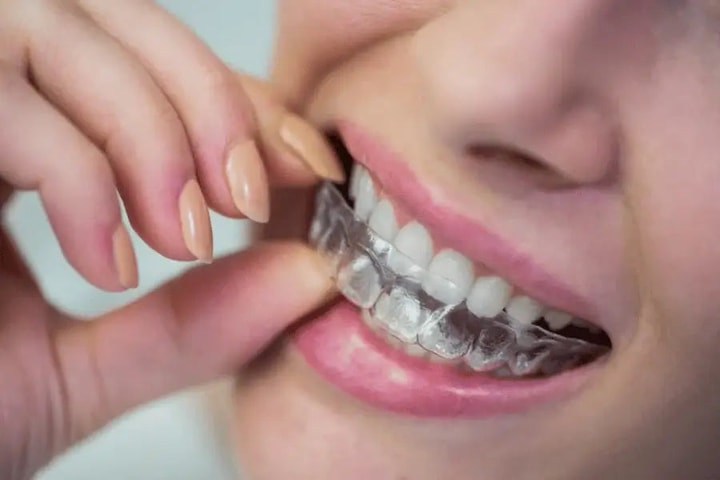 Best Savings Tip for Aligner32 Shoppers This July