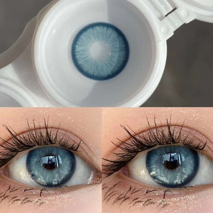 Other Opinions on Unicoeye